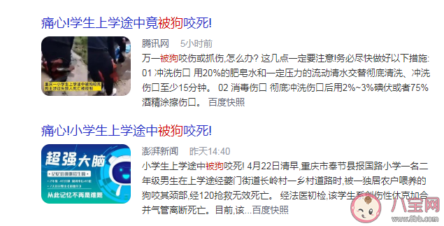 被狗咬著不放怎么辦 被狗咬傷后如何正確處理傷口