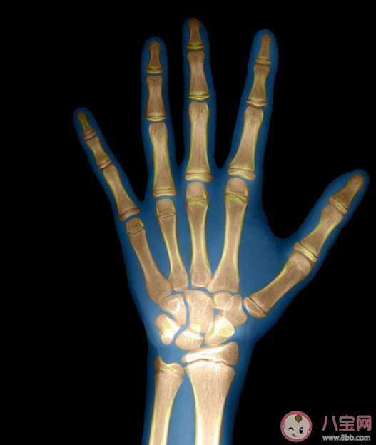 骨齡檢測最佳時間是什么時候 哪類人群需要檢測骨齡