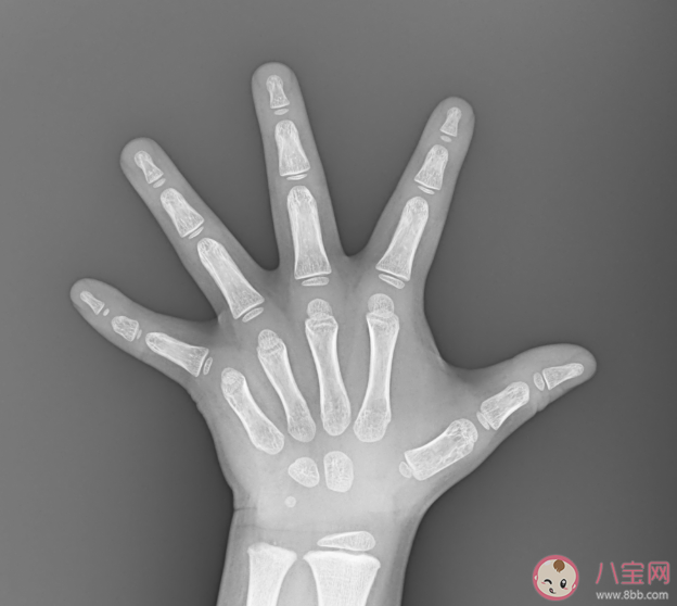 骨齡檢測最佳時間是什么時候 哪類人群需要檢測骨齡