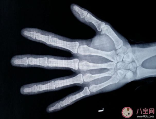 骨齡偏大需要治療嗎 骨齡偏大原因是什么