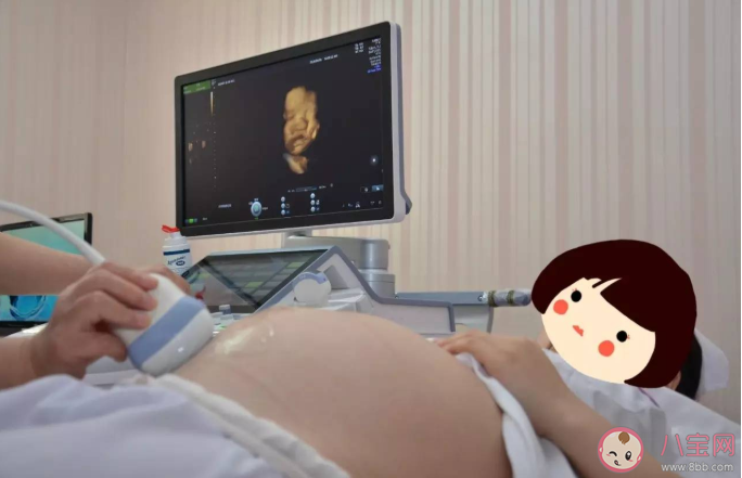 四維彩超能檢查出胎兒所有的缺陷嗎 四維彩超檢查有輻射嗎