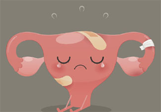 約70%卵巢癌患者發現就是晚期是為什么 卵巢癌早期有哪些癥狀表現