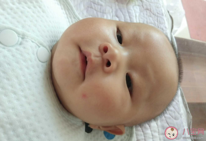 孩子睡覺時可以用驅蚊劑來防蚊嗎 怎么有效無毒害的去除嬰兒房間里的蚊子