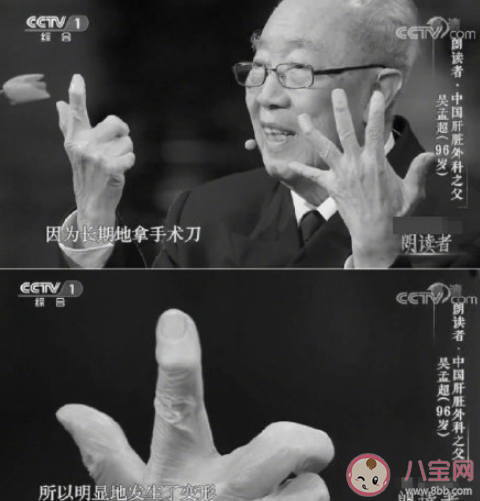 肝膽外科中堅力量八成是吳孟超學生 吳孟超院士生平事跡介紹