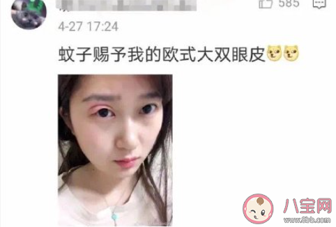 被蚊子叮過最尷尬的位置是哪 被蚊子咬了怎么止癢