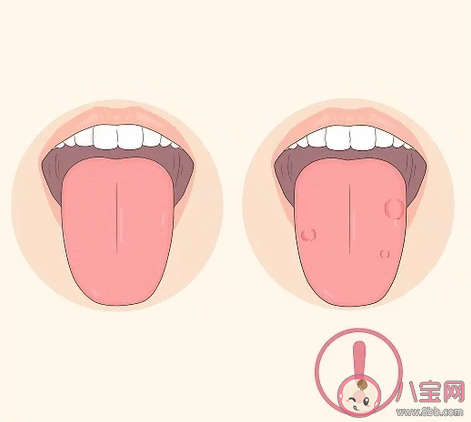 除了牙齒舌頭也需要經常清潔嗎 螞蟻莊園今日6月11日答案