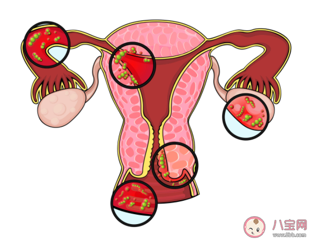 多囊懷孕為什么容易流產 多囊懷孕后怎樣預防流產