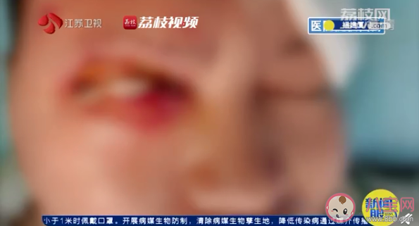 睡覺時(shí)充電器爆炸險(xiǎn)失明是怎么回事 睡覺時(shí)充電安全嗎