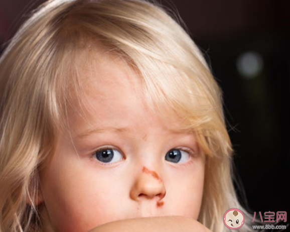 孩子前額磕出青包抹香油有用嗎 寶寶摔到前額有危險嗎