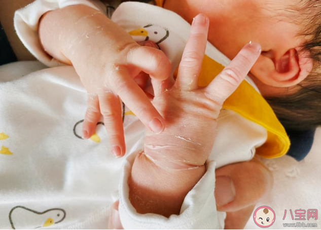 新生寶寶蛻皮后可以洗澡嗎 為什么新生兒會出現脫皮
