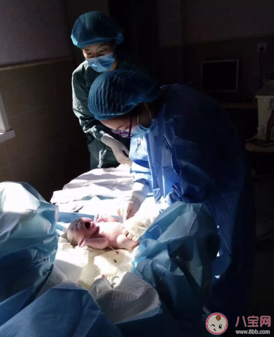 生孩子時(shí)為什么是頭先出來(lái) 生孩子為什么會(huì)順轉(zhuǎn)剖