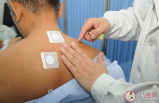 三伏貼為什么要在三伏天貼 三伏貼怎么選取穴位 三伏貼為什么要在三伏天貼 三伏貼怎么選取穴位