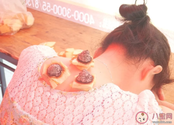 女性三伏灸有什么好處功效 三伏灸后應注意什么