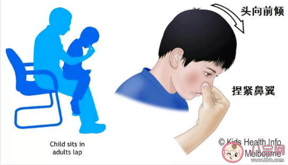 仰頭止鼻血有什么危害 正確止鼻血方法是什么