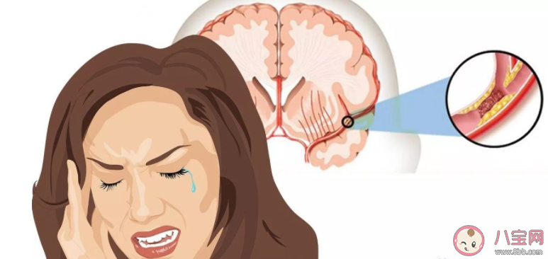 男孩戴風(fēng)扇睡覺被吹面癱是怎么回事 夏季為什么容易發(fā)生面癱