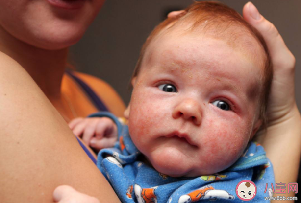 孩子洗澡水里滴去痱水有用嗎 夏天怎么預(yù)防寶寶起痱子 孩子洗澡水里滴去痱水有用嗎 夏天怎么預(yù)防寶寶起痱子