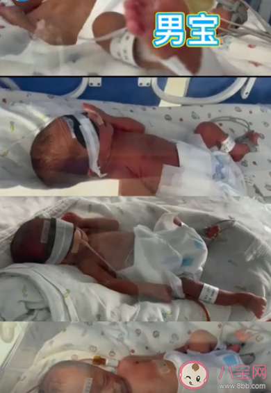 新鄉一產婦第三胎生下龍鳳四胞胎 懷了多胞胎要注意些什么