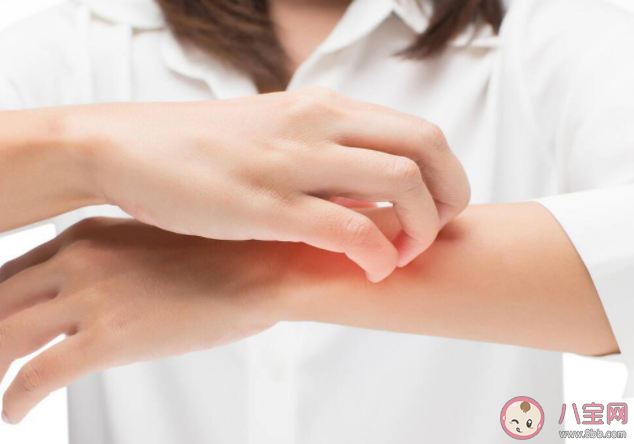 一到夏天就長(zhǎng)的小水泡是什么 患上汗皰疹怎么辦