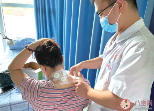 三伏貼貼敷后皮膚有哪些反應(yīng) 三伏貼能代替治療嗎