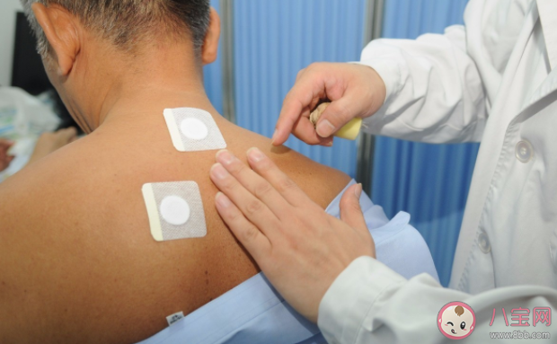 三伏貼貼敷后皮膚有哪些反應(yīng) 三伏貼能代替治療嗎