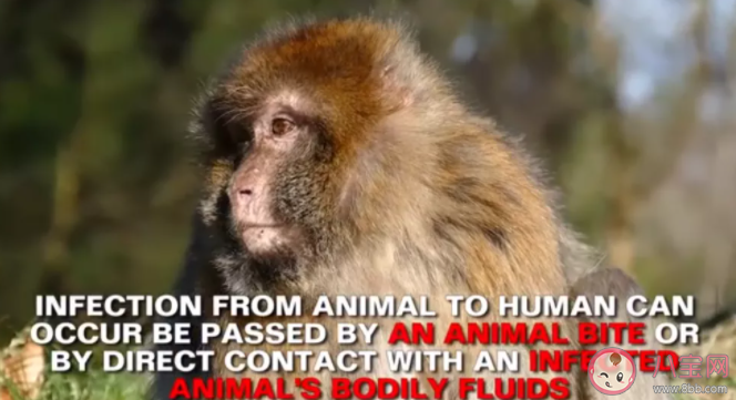 美國近20年來出現首例猴痘病毒病例 猴痘病毒有什么癥狀表現