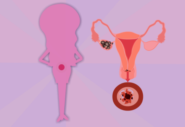 宮頸管多長(zhǎng)比較正常 宮頸管篩查孕多少周檢查