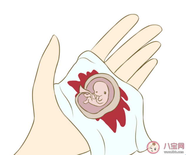 孕早期反復流產都是女方的問題嗎 反復流產后就不能懷孕了嗎 孕早期反復流產都是女方的問題嗎 反復流產后就不能懷孕了嗎