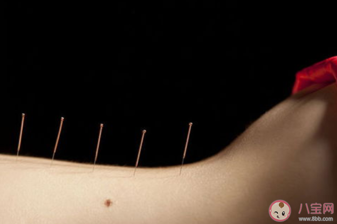 埋線減肥原理是什么 埋線減肥有什么危害風(fēng)險(xiǎn)