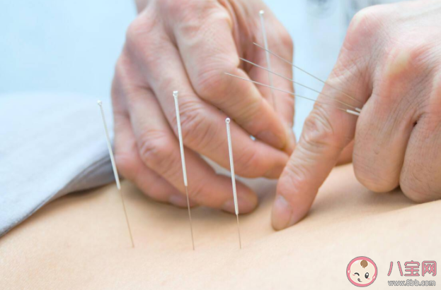 埋線減肥原理是什么 埋線減肥有什么危害風(fēng)險(xiǎn)