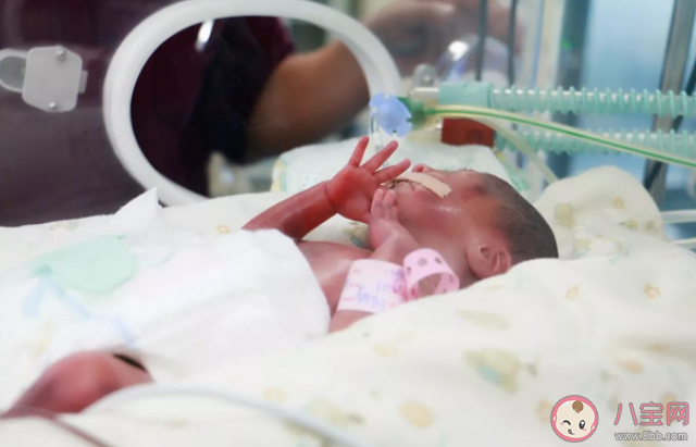 34周早產兒活下來的幾率有多高 早產兒長大后有缺陷嗎