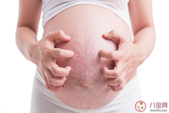 妊娠紋的發展過程是怎樣的 祛除妊娠紋的產品真的有效嗎