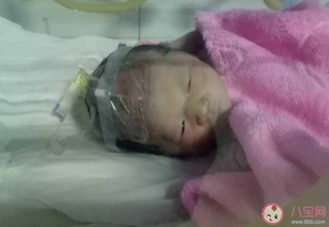 孕38周卸貨屬于早產(chǎn)嗎 預(yù)產(chǎn)期前出生的都是早產(chǎn)兒?jiǎn)? alt=