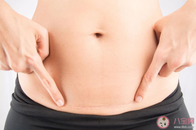 二胎剖腹產和第一胎剖腹產有什么區別 剖腹產媽媽生二胎注意什么 二胎剖腹產和第一胎剖腹產有什么區別 剖腹產媽媽生二胎注意什么