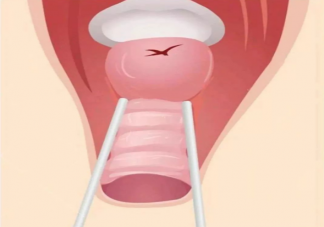 順產(chǎn)后陰道會(huì)變松弛嗎 順產(chǎn)下面變松弛多久能恢復(fù)