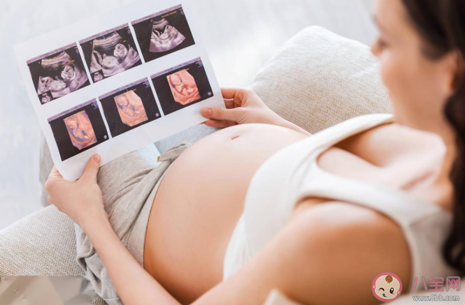 胎心監測不合格是胎兒缺氧了嗎 胎心監護每周都要做一次嗎 胎心監測不合格是胎兒缺氧了嗎 胎心監護每周都要做一次嗎