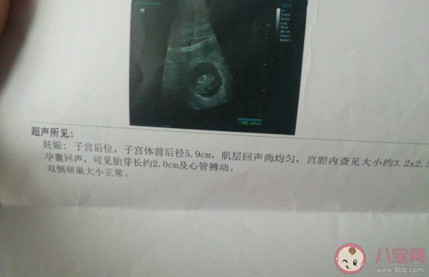 寶寶胎心胎芽一般幾周會(huì)有 孕檢不見(jiàn)胎芽胎心是有問(wèn)題嗎 寶寶胎心胎芽一般幾周會(huì)有 孕檢不見(jiàn)胎芽胎心是有問(wèn)題嗎