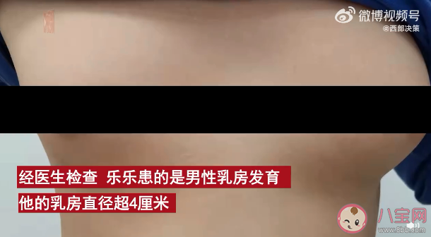 11歲男孩乳房發(fā)育直徑超4厘米是怎么回事 男性乳房發(fā)育正常嗎 11歲男孩乳房發(fā)育直徑超4厘米是怎么回事 男性乳房發(fā)育正常嗎