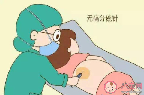 生孩子有必要打無痛嗎 要不要打無痛分娩針