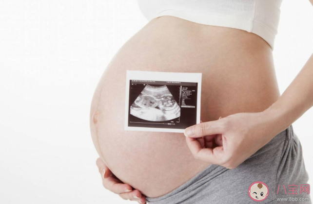 懸浮肚為什么不建議順產 懸浮肚有什么風險