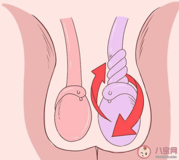 孩子蛋蛋不一樣大正常嗎 睪丸大小不一怎么辦