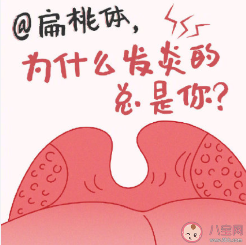 為什么扁桃體總是發(fā)炎 扁桃體經(jīng)常發(fā)炎怎么辦