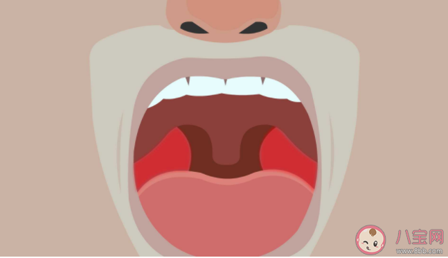 扁桃體發炎要不要割掉 割了扁桃體免疫力會下降嗎 扁桃體發炎要不要割掉 割了扁桃體免疫力會下降嗎