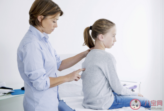 脊柱側彎最佳手術年齡是幾歲 如何糾正脊柱側彎 脊柱側彎最佳手術年齡是幾歲 如何糾正脊柱側彎