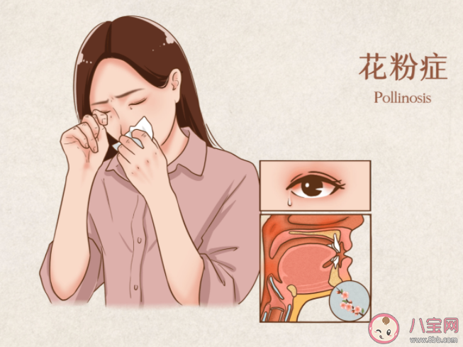 花粉過敏的人不易患癌嗎 嚴重的花粉癥會引起什么后果
