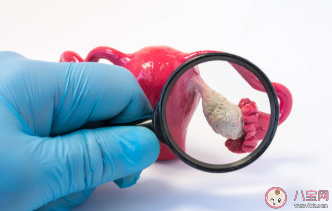 患有多囊卵巢綜合征就代表不孕嗎 沒有生育需求多囊不用治療嗎