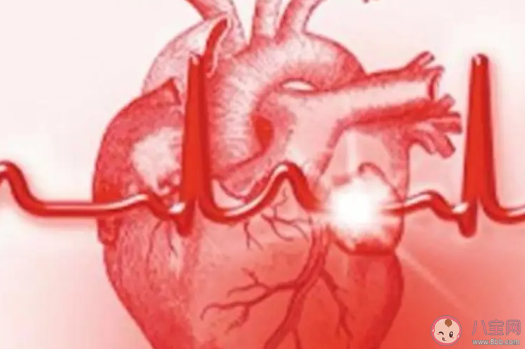 哪些生活習慣會誘發心梗 該怎樣預防心梗的產生 哪些生活習慣會誘發心梗 該怎樣預防心梗的產生