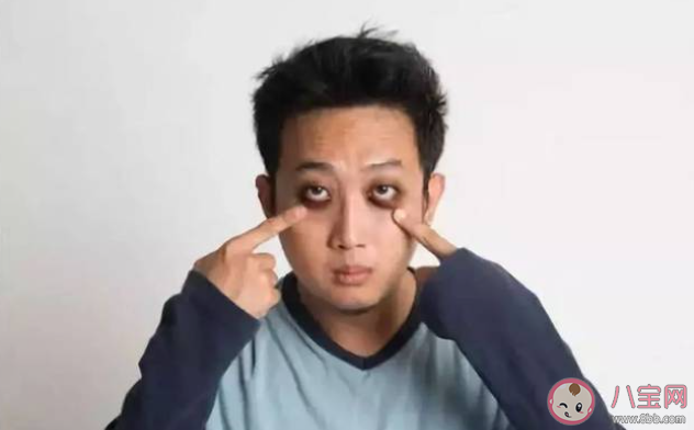為什么不熬夜也會有黑眼圈 該如何消除黑眼圈