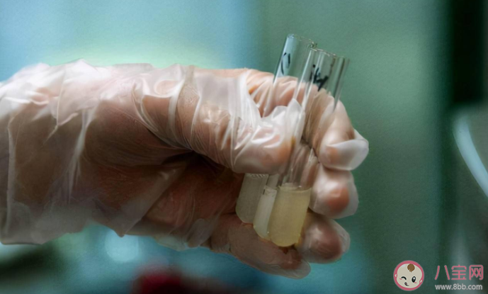 捐精要什么條件會有補貼嗎 捐精的好處有什么