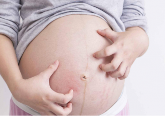 妊娠糖尿病和胖瘦有關(guān)系嗎 孕期血糖高怎樣控制