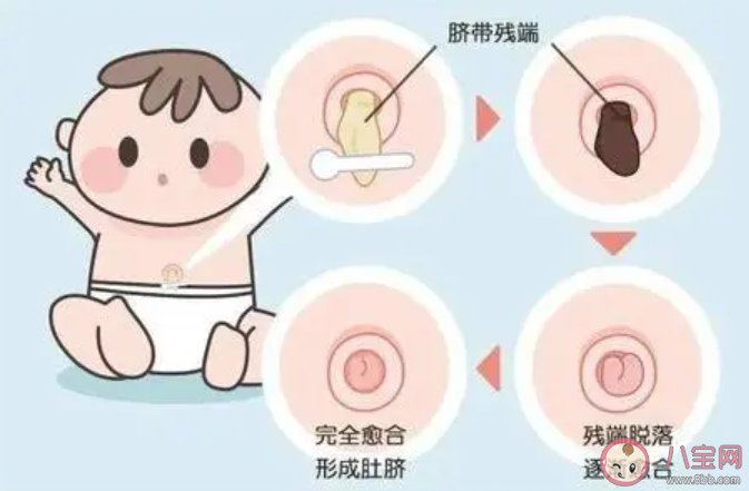 摳肚臍眼有哪些危害 肚臍眼的臟東西怎么解決